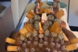 神秘一幕！30岁奥纳纳拔罐康复，肩部到小腿布满罐印